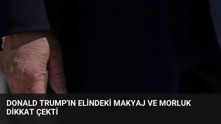 Donald Trump’ın Elindeki Makyaj ve Morluk Dikkat Çekti